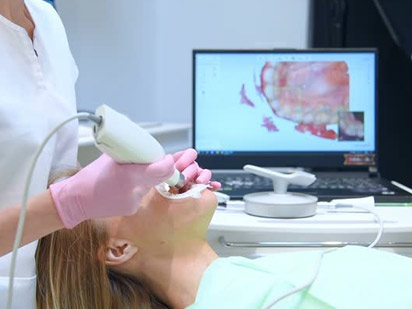 Digital Impressions and Scanners